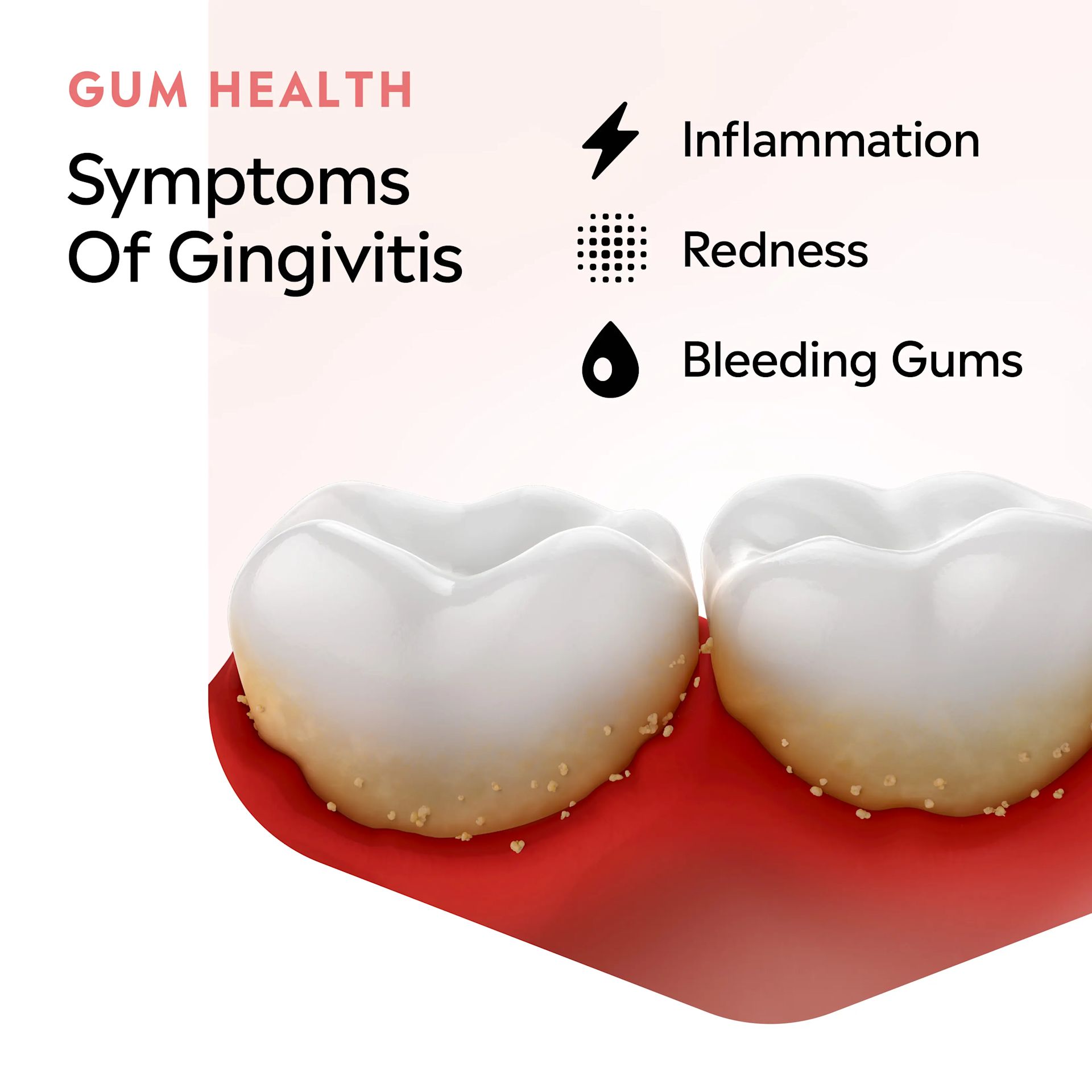 LISTERINE® Gum Health, symptoms of gingivitis, inflammation, redness and bleeding gums