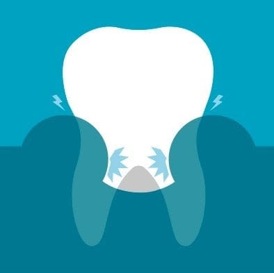 PUFFY GUMS