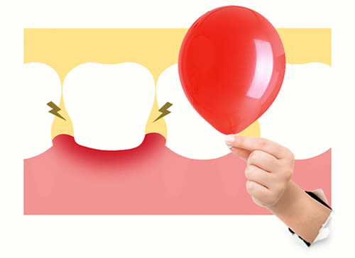 swollen-gums-lores-id-id-Listerine