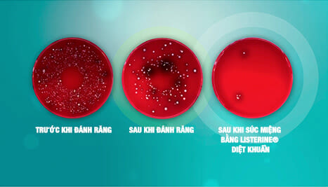 Vì sao nên dùng LISTERINE®?