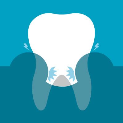symptoms-of-gum-problems-2.jpg