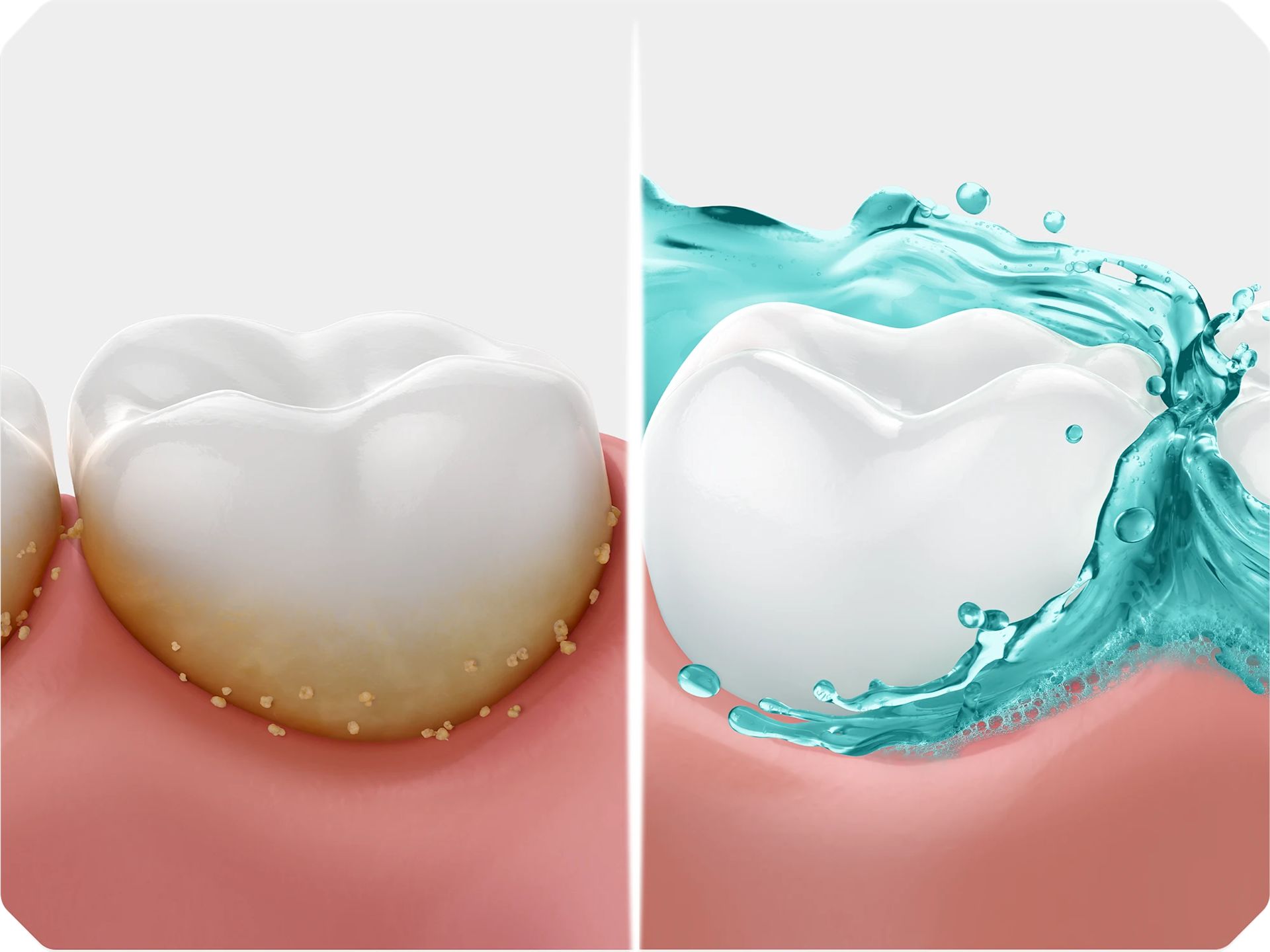 Dental Plaque overview. What is plaque and why does buildup matter?