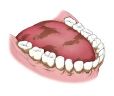 Teeth after brushing and cleaning