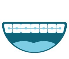 Uso de enjuague bucal para personas con brackets (ortodoncia)