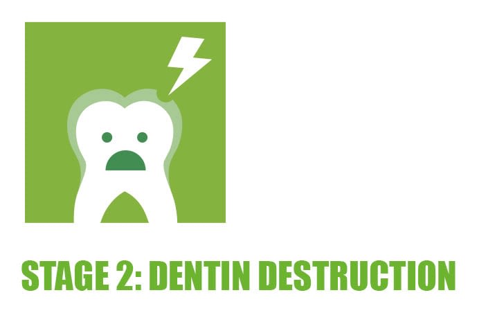 decay-cavity-how-teeth-become-damaged-desktop-19