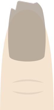 咬指甲會同時傷害口腔和雙手