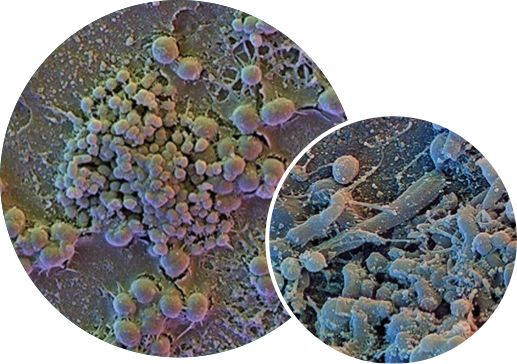 Side by side 2 graphic images of Plaque biofilm