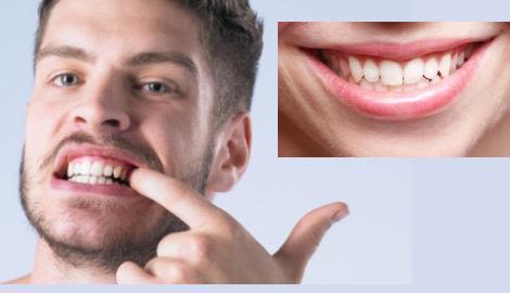 3-6-gums_1_3-tr-tr-Listerine
