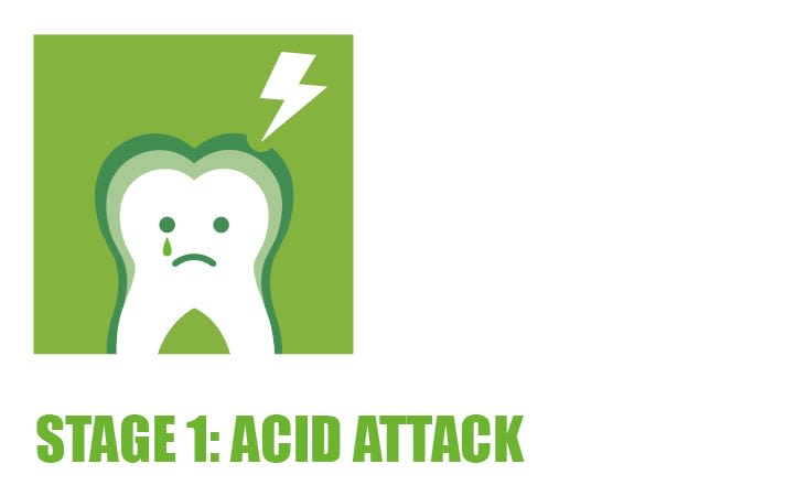 decay-cavity-how-teeth-become-damaged-desktop-17