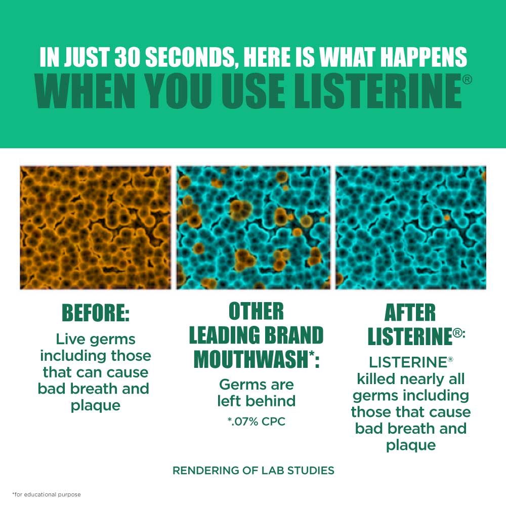 LISTERINE® FRESH BURST - Image 5 - Listerine - en-MY