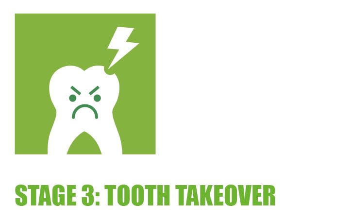 decay-cavity-how-teeth-become-damaged-desktop-23