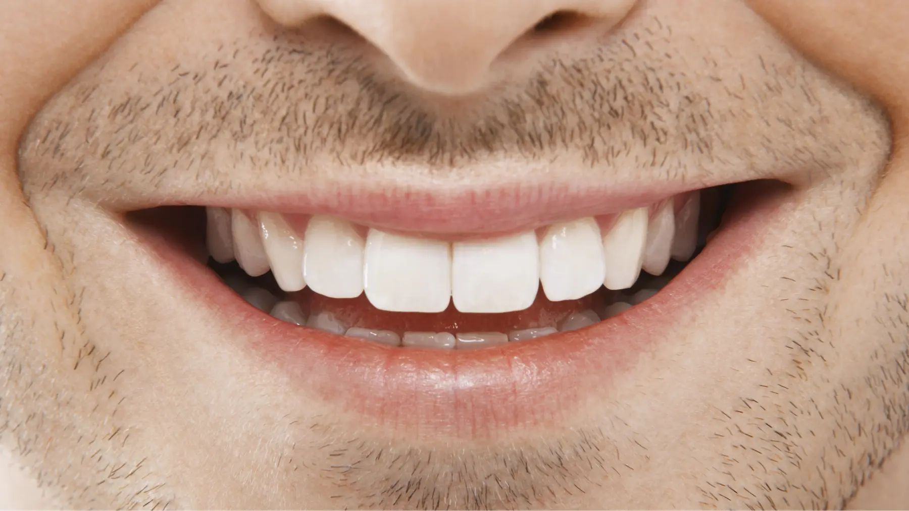 An image featuring a close-up of a man's smiling mouth with white, clean and great enamel teeths