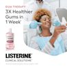 JS 4785 LIST ClinicalSolutions DigitalTiles GumTherapy ENG