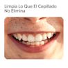 Enjuague Bucal LISTERINE® Smart Rinse® para niños, sabor frutos rojos