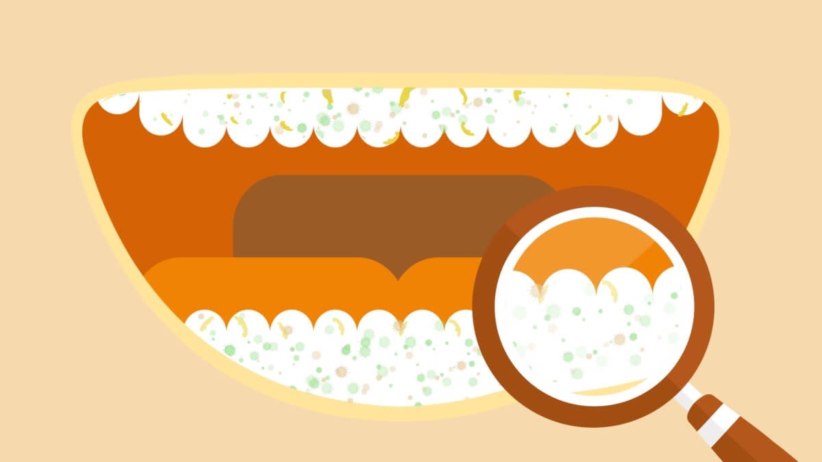 tartar_2-en-gb