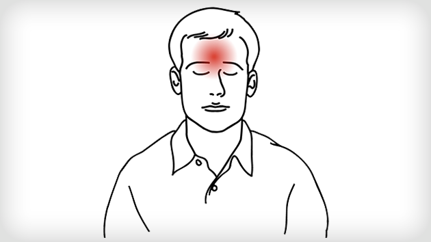 Strunkly Forehead Cough Remedies & Cold Medicine | SUDAFED® New Zealand