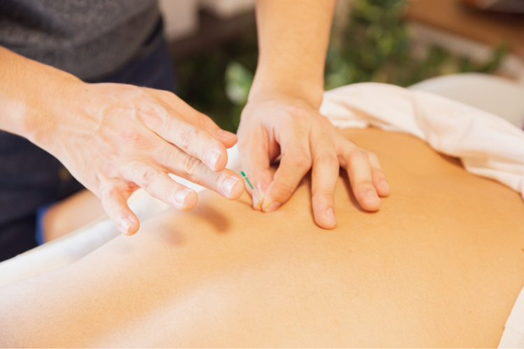 A person receiving acupuncture that is covered by Medicare Part B.