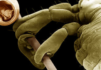 Elektronenmicroskopische Aufnahme eines Lausfußes am Haar