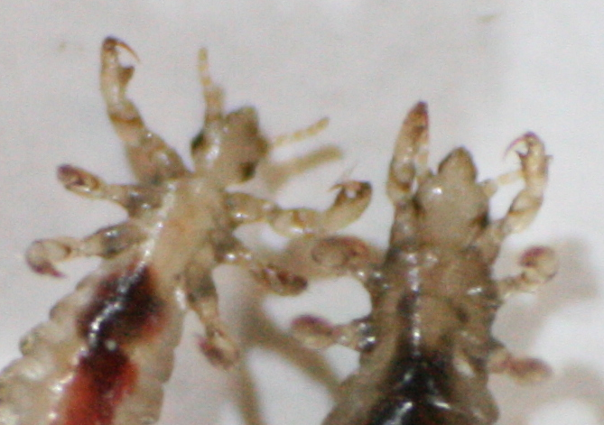 Großaufnahme der Läusebeine mit Greiffüßen.