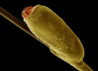 Nisse in elektronenmicroskopischer Aufnahme