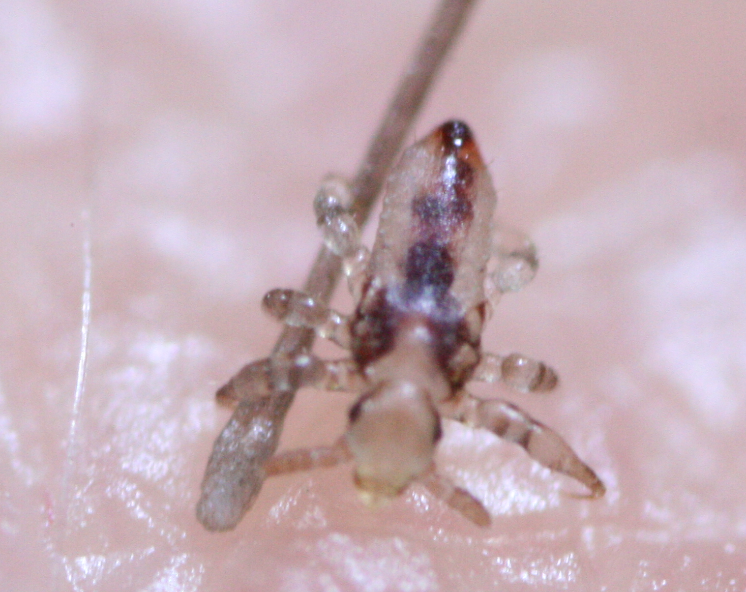 Eine Laus im ersten Larvenstadium