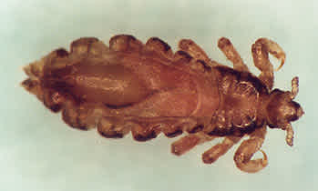 Weibliche Kopflaus