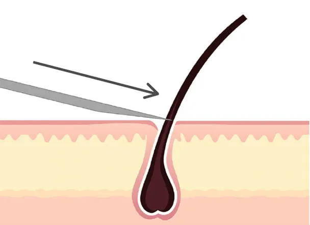 Illustration showing a razor blade cutting beard hair at skin level in wet shaving