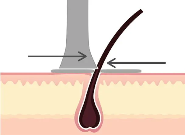 Diagram of electric shaver cutting beard hair between two blades like scissors