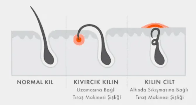 Tıraş sırasında, birçok neden jiletle çarpma olasılığını artırabilir