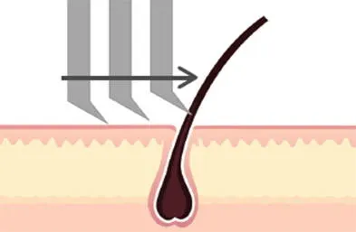 Illustration of razor lifting hair from follicle before cutting for a closer shave