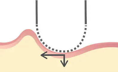 Close-up of electric foil shaver with perforated metal foil and undercutter blades