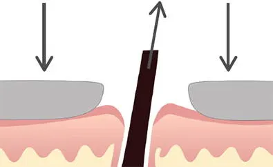 Diagram showing electric shaver pressing skin to create bow wave for better shave