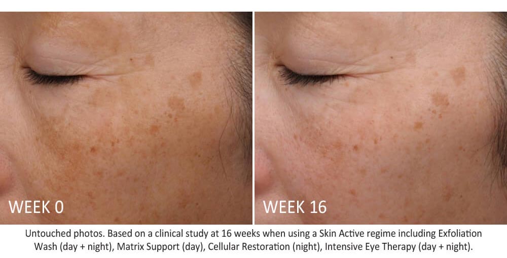 skin-active-exfoliating-wash-results