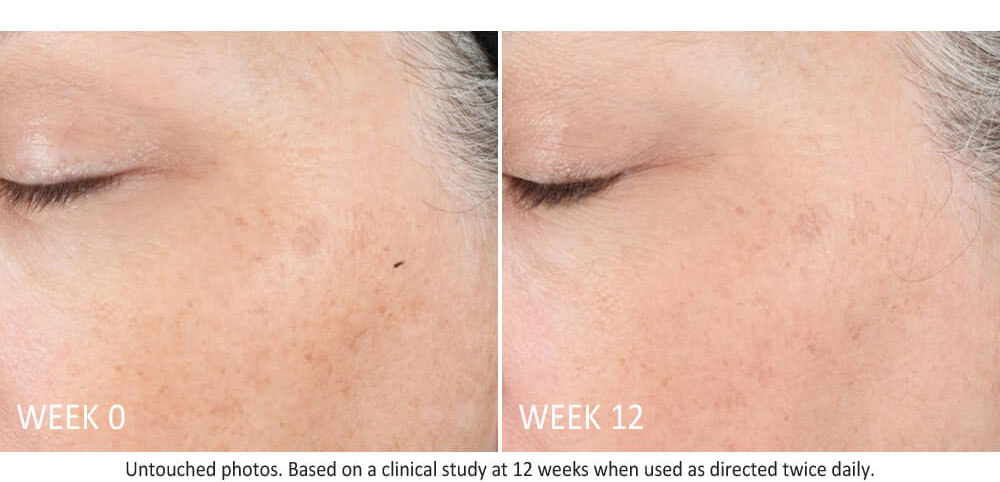 skin-active-lifting-serum-results-3