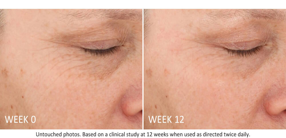 skin-active-lifting-serum-results-2