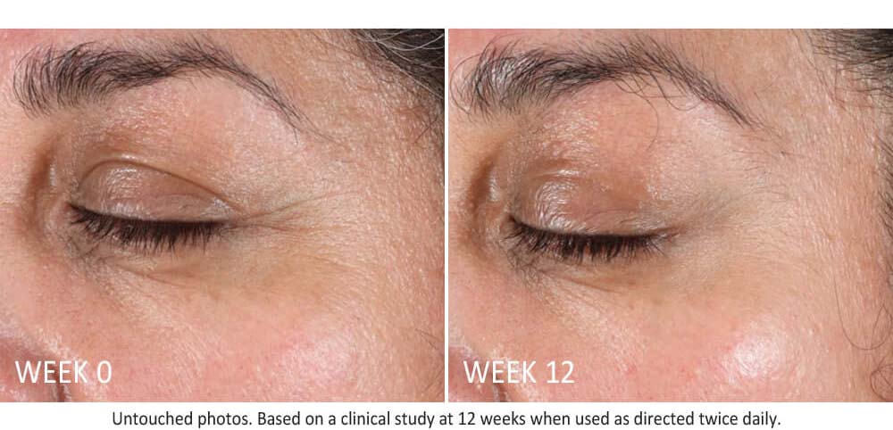 skin-active-lifting-serum-results