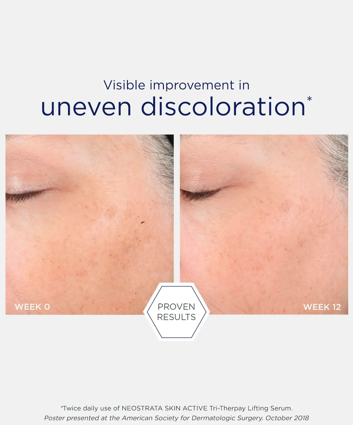 NEOSTRATA® SKIN ACTIVE TRI-THERAPY LIFTING SERUM image 3
