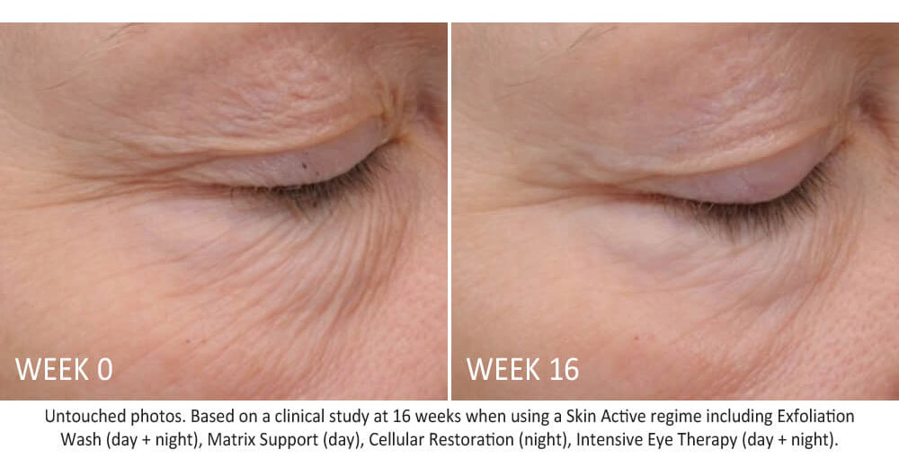 skin-active-intensive-eye-therapy-results