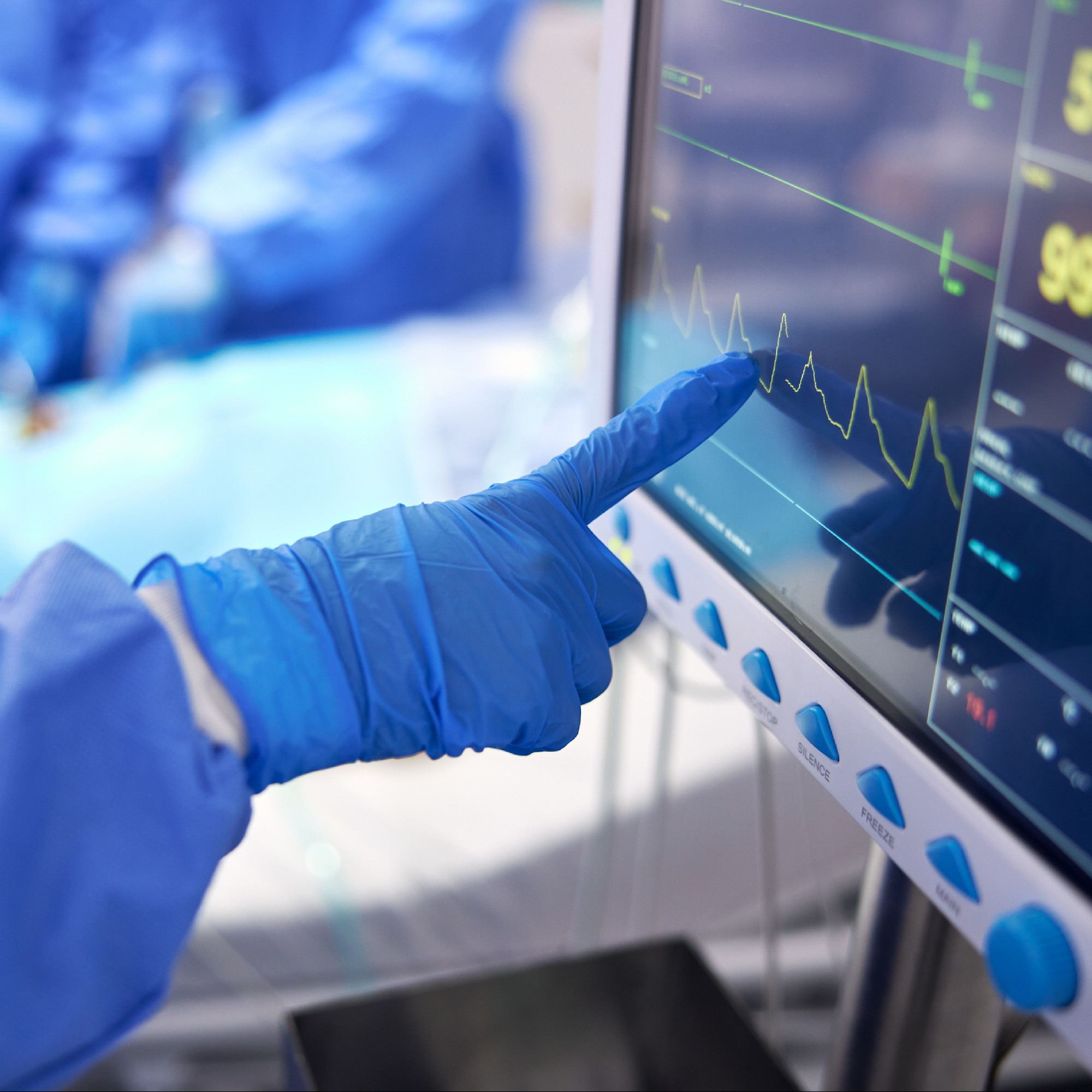 A hand gently tapping the surface of a medical monitor's touch screen. The screen displays various vital signs and data.