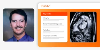 STATdx Step Forward Testimonial - Dr Charles G Hood - Prisma Health USA