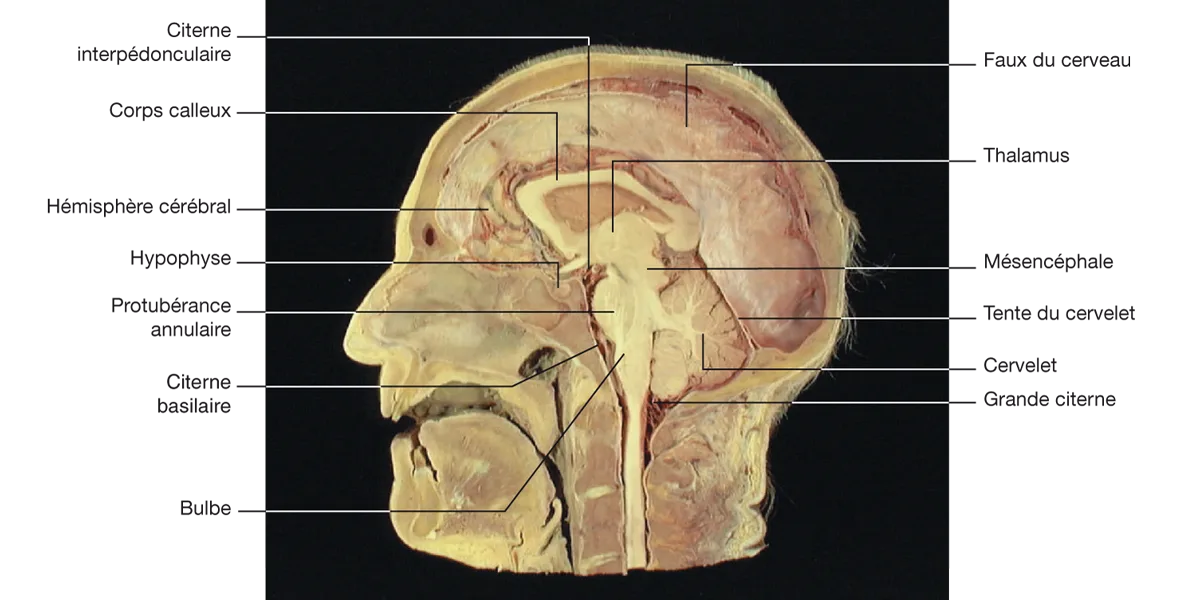 Figure 5.2 Coupe sagittale médiane de la tête, montrant la disposition de l’encéphale et des méninges.