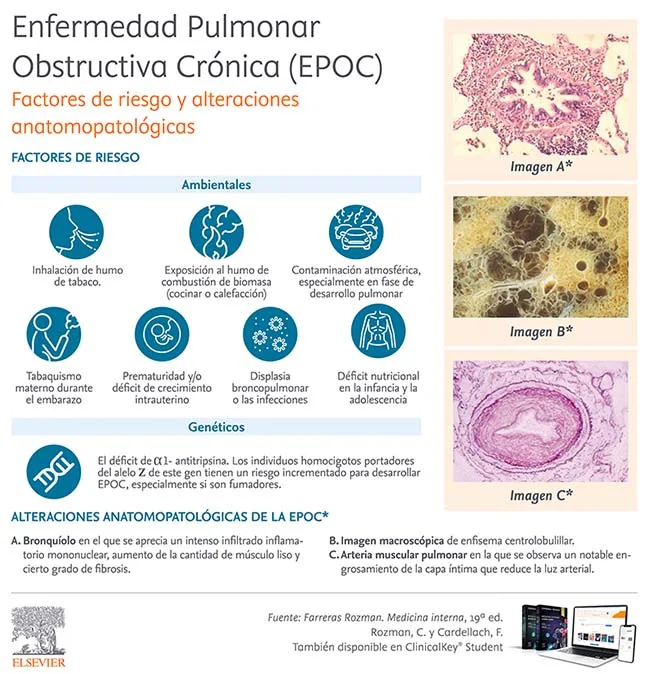 Infografia Enfermedad Pulmonar 1