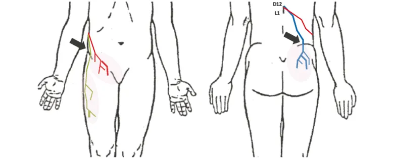 Innervation cutanée des branches latérales de D12 et L1. 