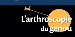 Banner - L'arthroscopie du genou