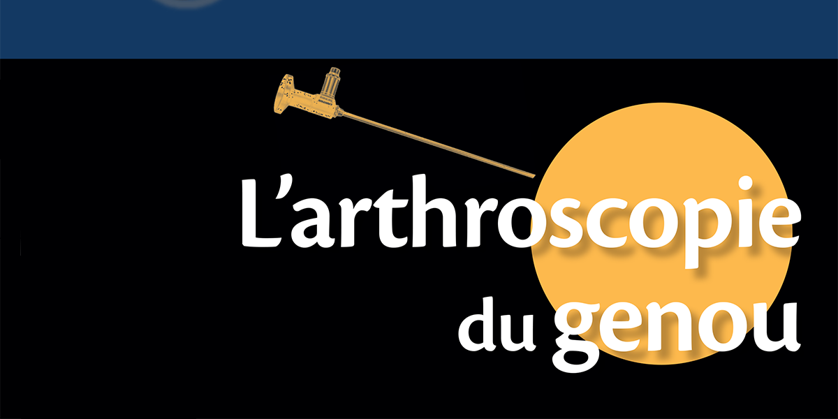 Traitement chirurgical des fractures articulaires du genou