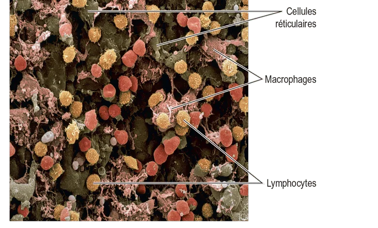  Microscopie à la balayage électronique de tissu de nœud lymphatique. La population cellulaire comprend des cellules réticulaires (en brun), des macrophages (en rose) et des lymphocytes (en jaune).