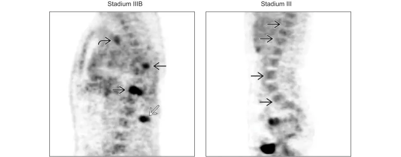 TEP FDG sagittal