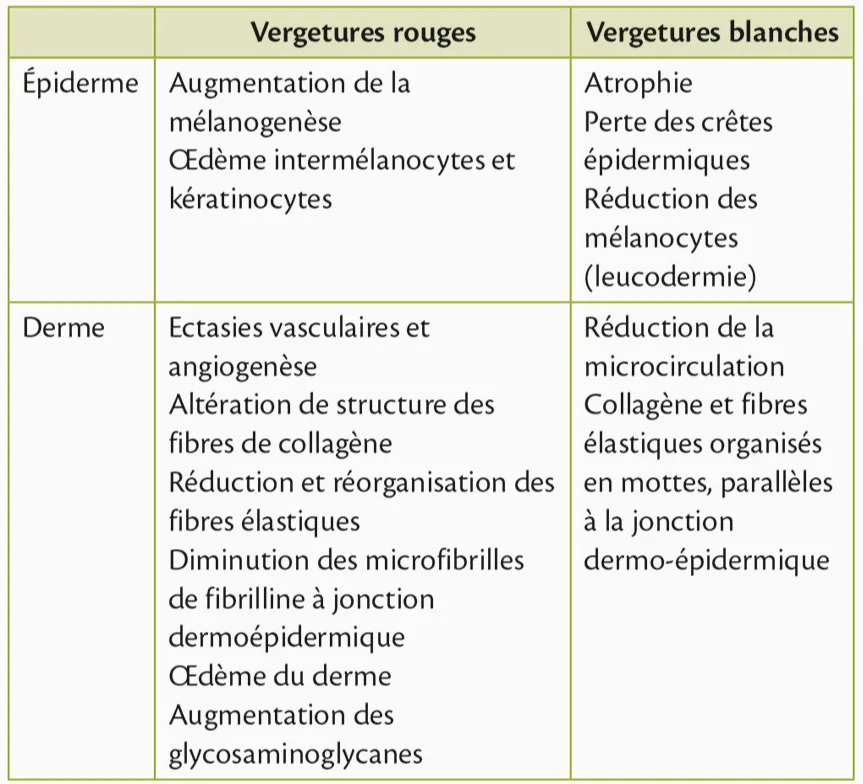 Histologie des vergetures