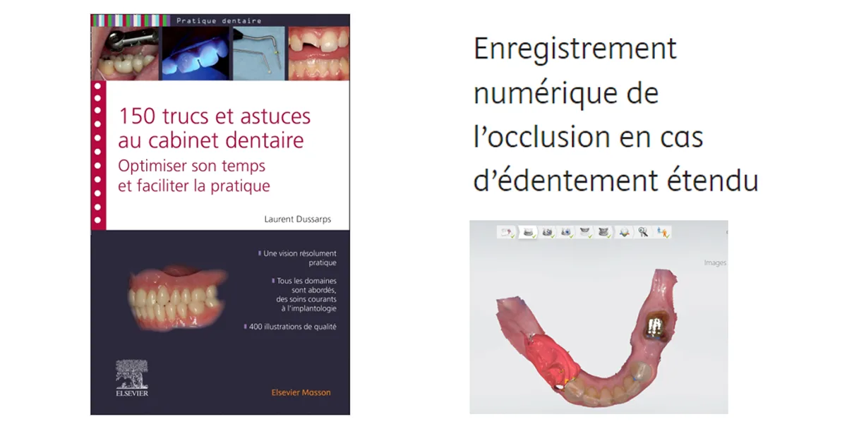 La 151e astuce du Dr Laurent Dussarps, chirurgien-dentiste