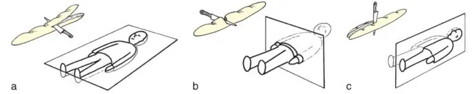 un plan frontal de référence (a), un plan transversal (b) et un sagittal (c).